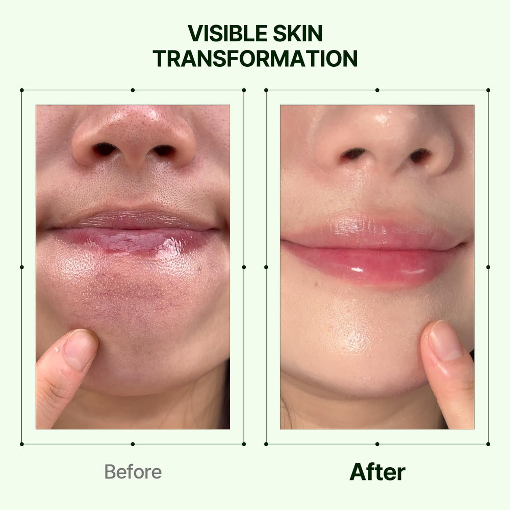 Orien Mugwort Zero Film: exfoliación suave con 0,5% BHA para controlar el sebo.