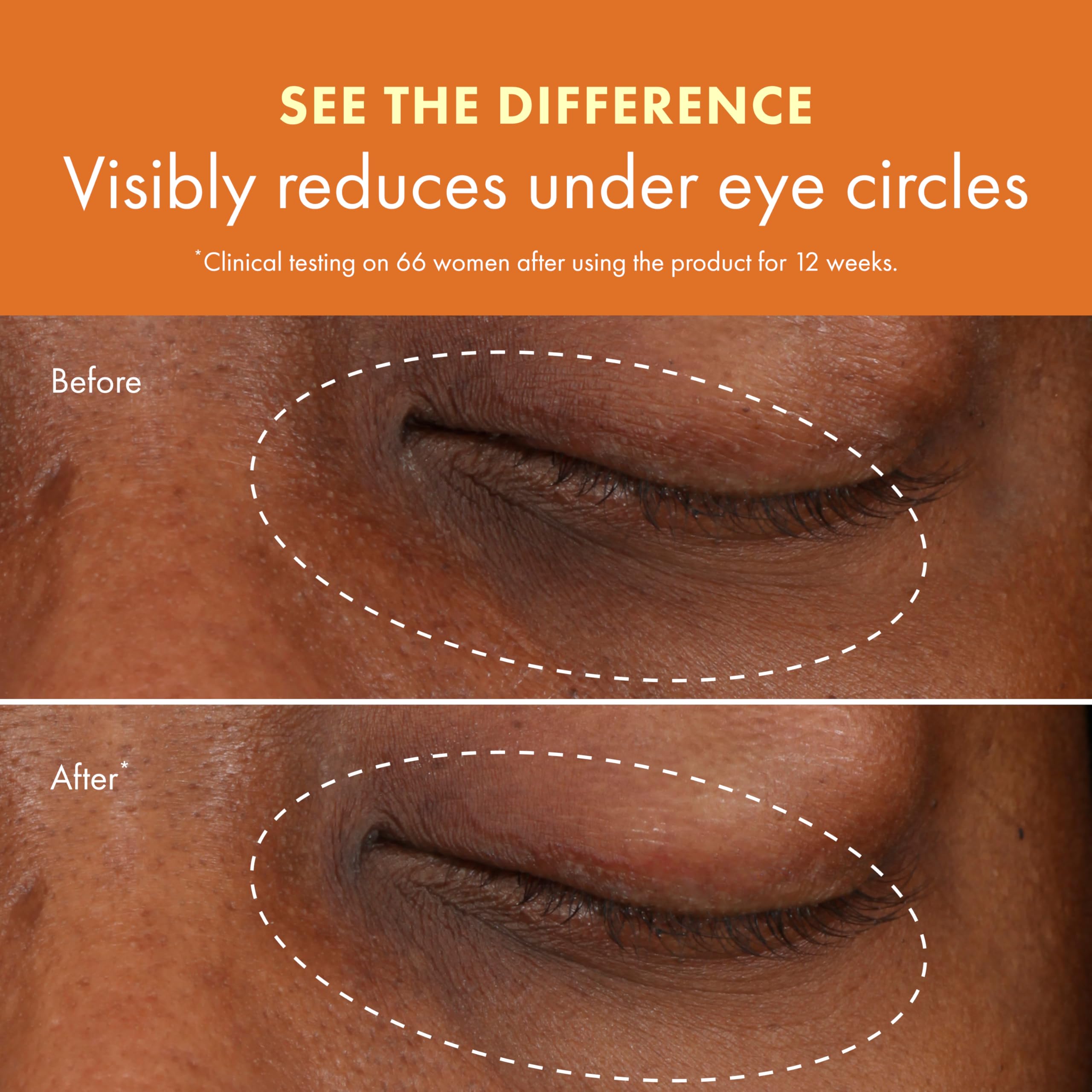 Niacinamide in Origins GinZing eye cream brightens under eyes.