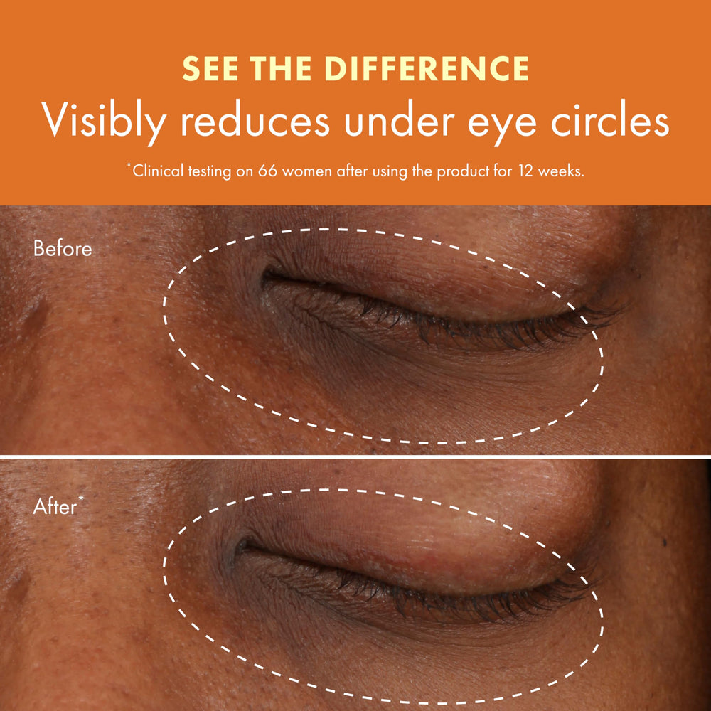 Niacinamide in Origins GinZing eye cream brightens under eyes.