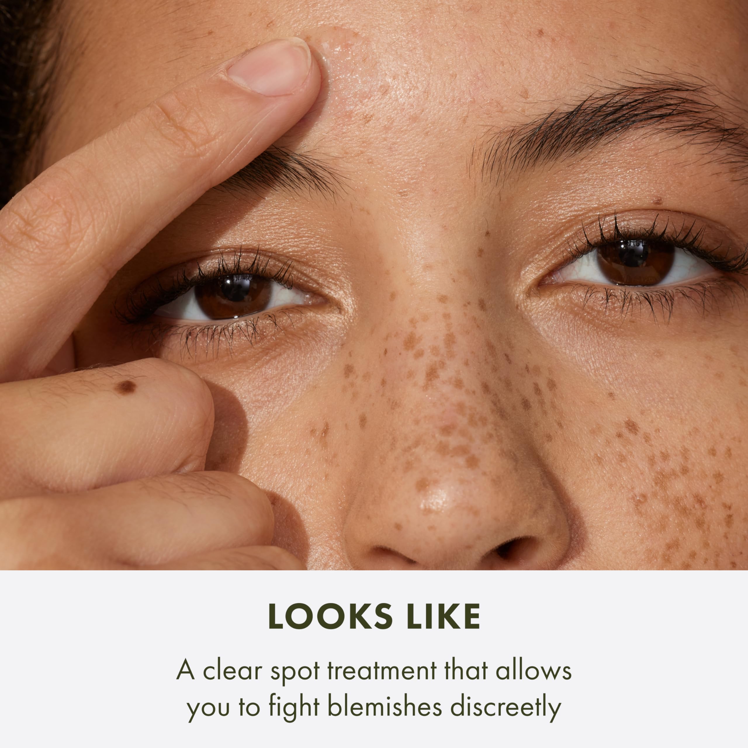 Origins Super Spot Tratamiento: contiene ácido salicílico para limpiar poros y prevenir brotes.