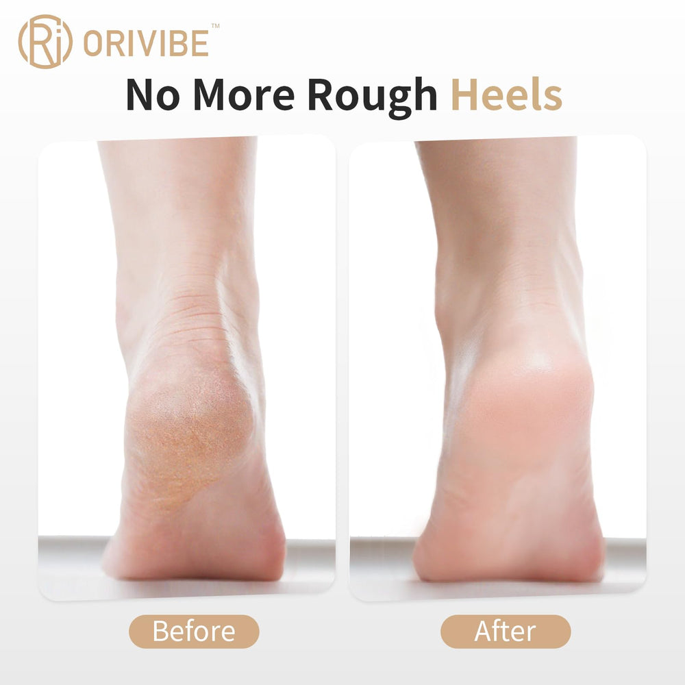 Orivibe dual rollers close-up showing fine and coarse textures for exfoliation