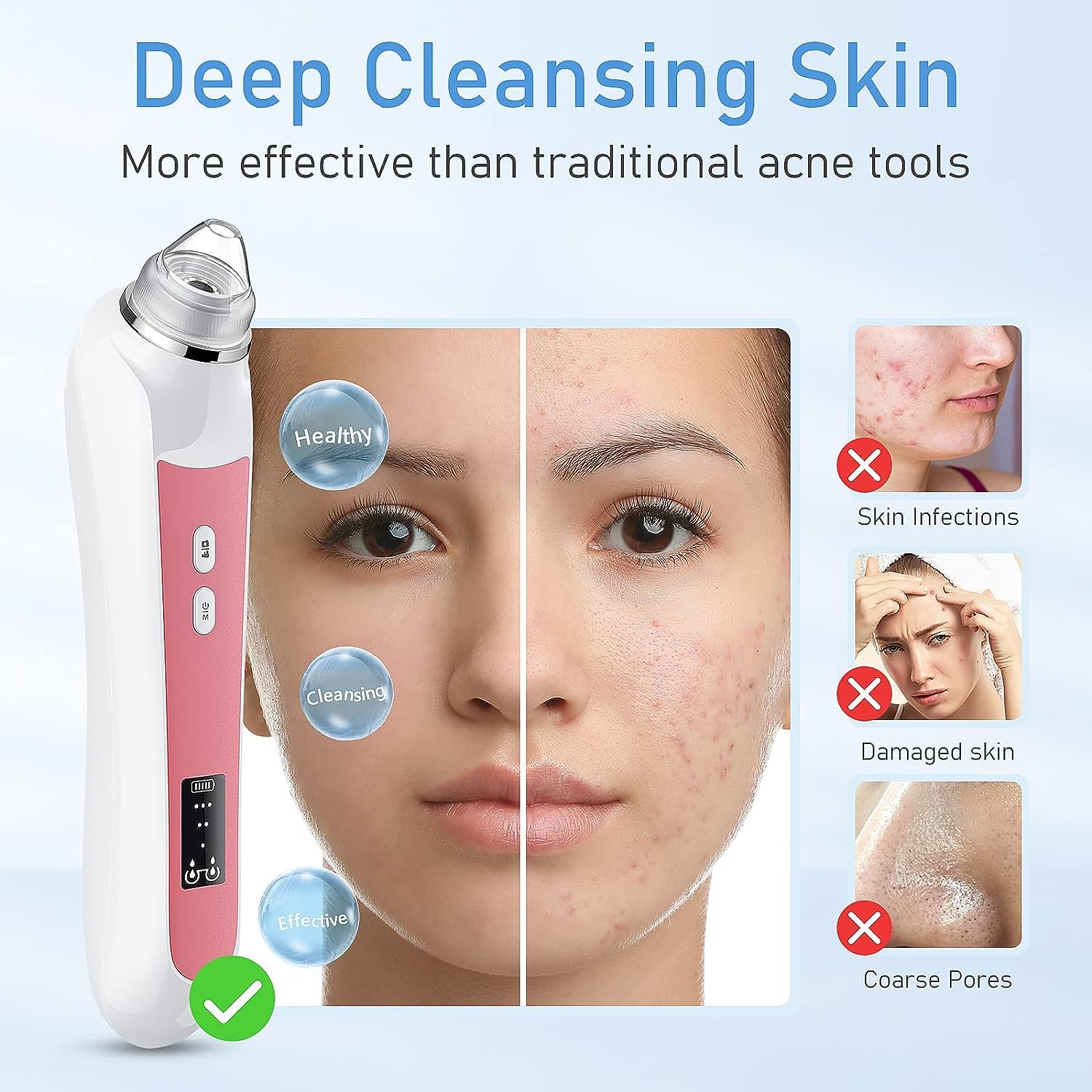 Ottleba Blackhead Remover Vacuum USB charging for convenient on-the-go use.