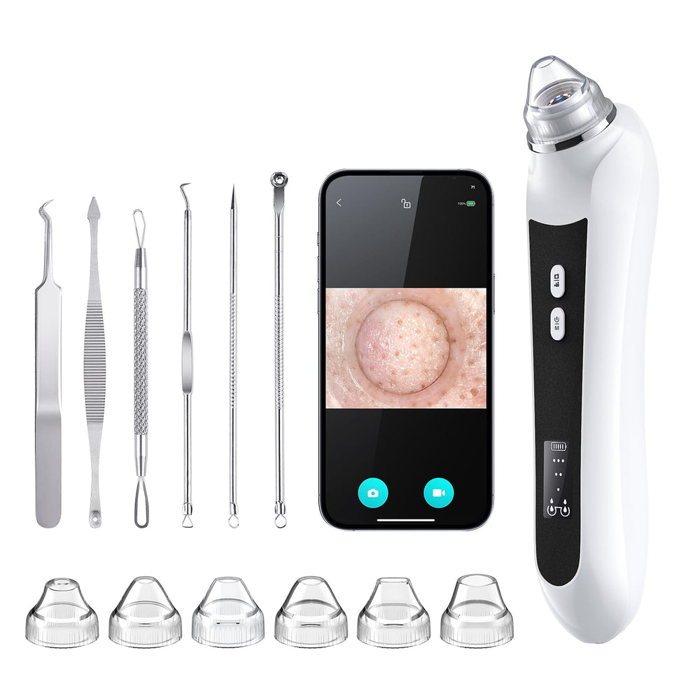 Ottleba Blackhead Vacuum with 1080p camera view for precise pore cleaning.