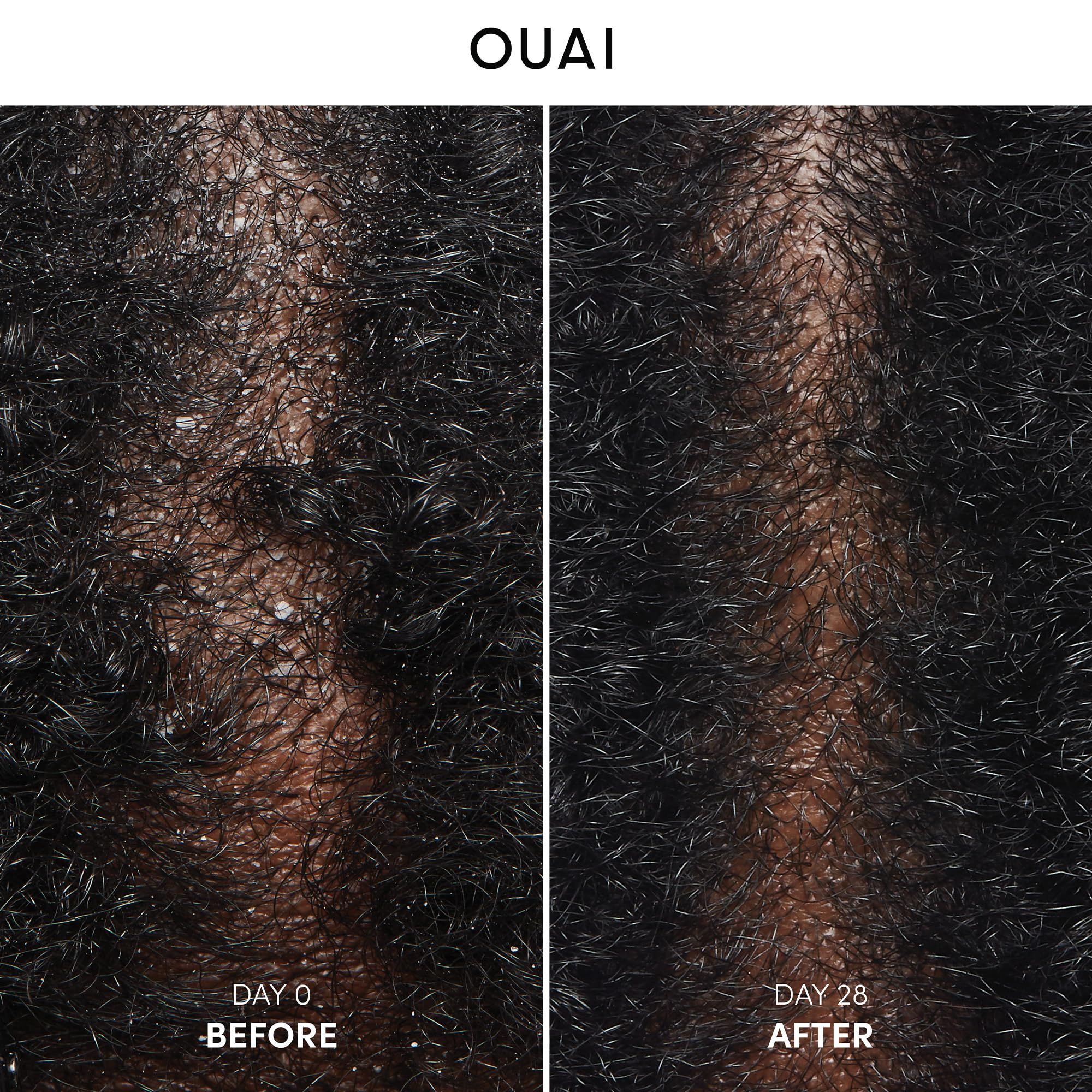 OUAI shampoo lather demonstrates gentle cleansing for irritated scalps.