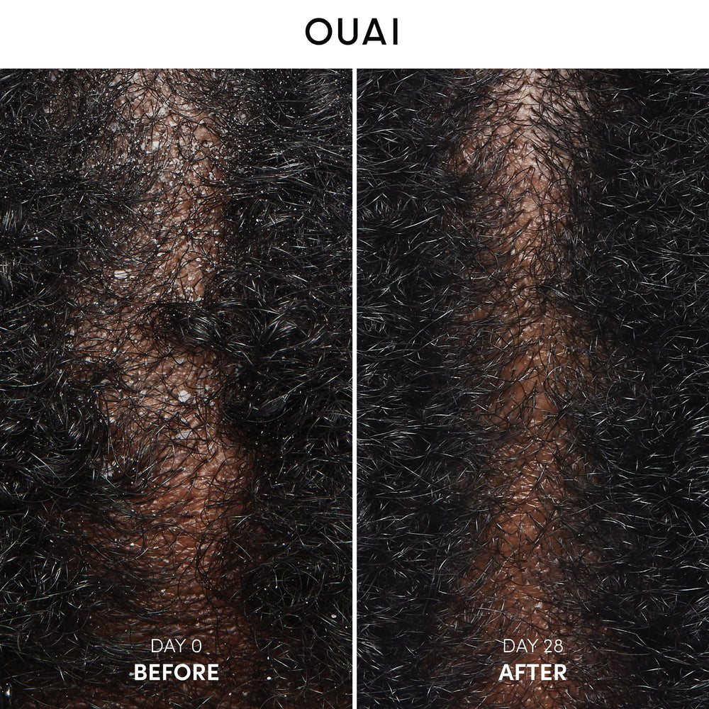 OUAI shampoo lather demonstrates gentle cleansing for irritated scalps.