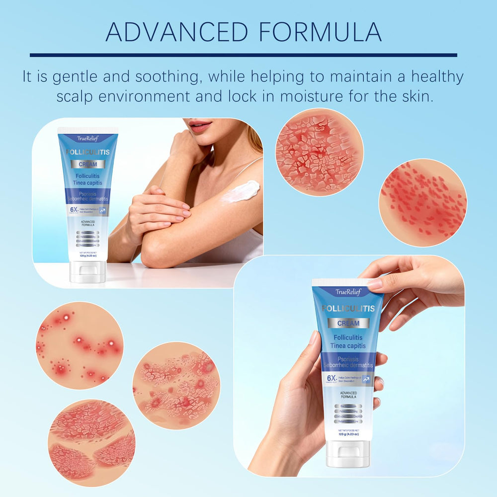OUHENGTEK Crema Foliculitis, uso tras limpieza para zonas objetivo