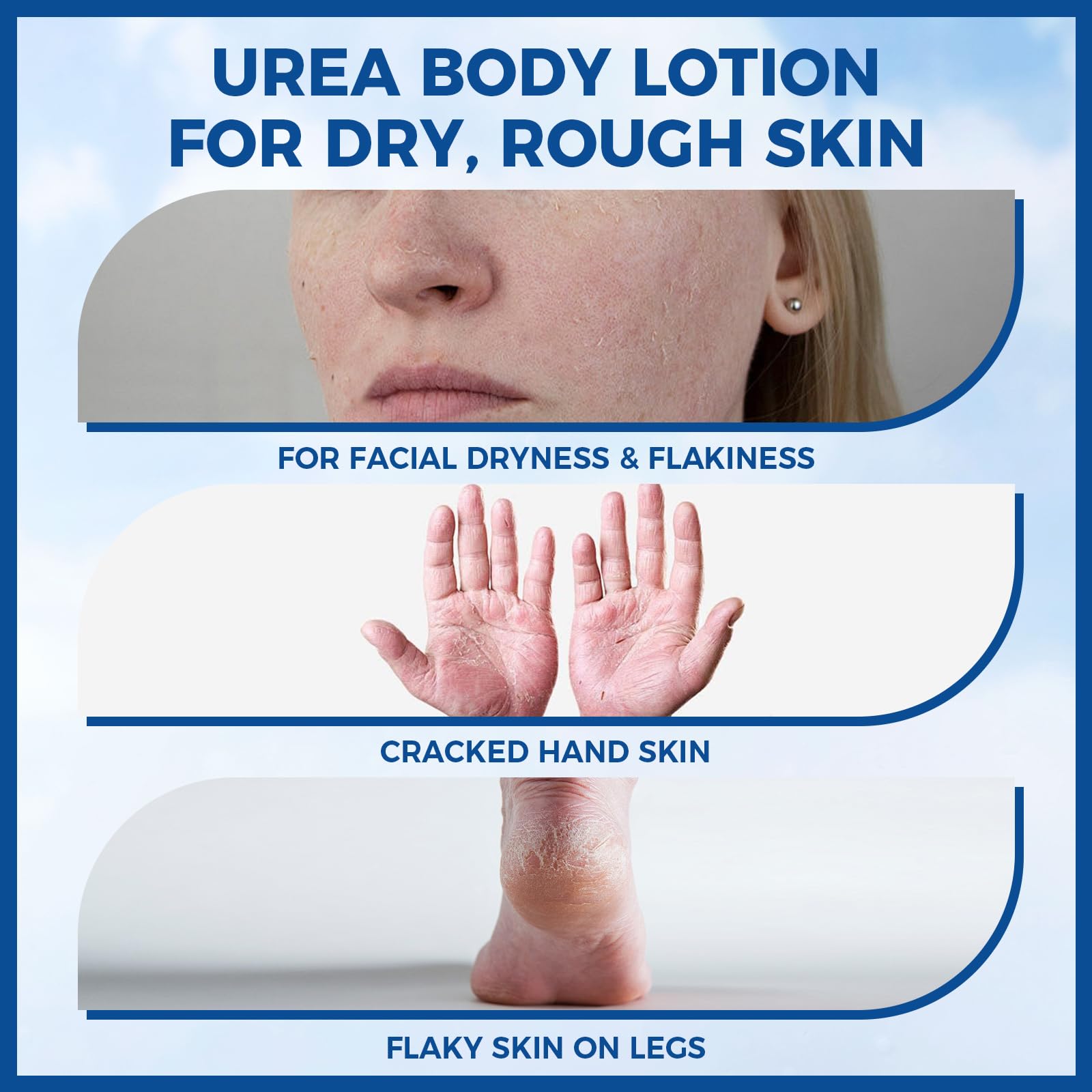 OUKEYA crema urea cuerpo muestra hidratación 48 horas.