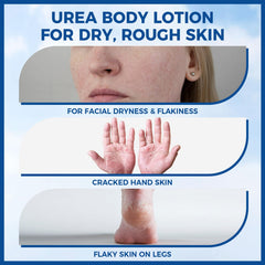 OUKEYA crema urea cuerpo muestra hidratación 48 horas.