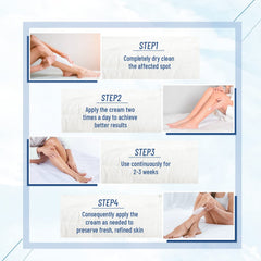 OUKEYA dermatologist-tested urea cream for rough skin