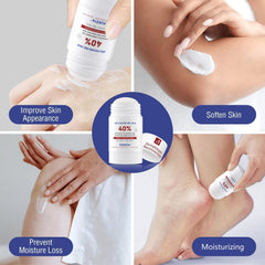 OUKEYA Urea Cream 40% for elbows and knees softening rough patches