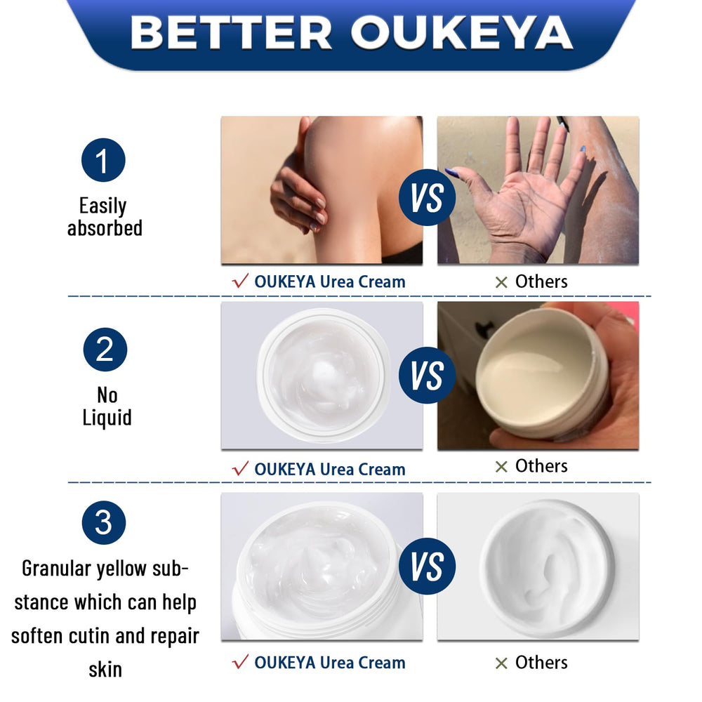 OUKEYA Urea Cream 40% elbows knees care after long wear.
