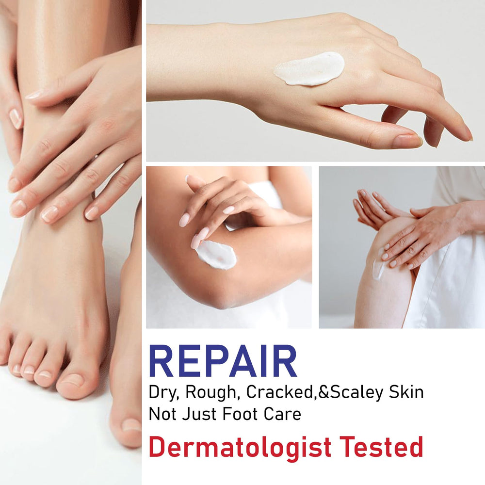 OUKEYA Urea Cream 40% texture demonstrates lightweight, non-greasy hydration.