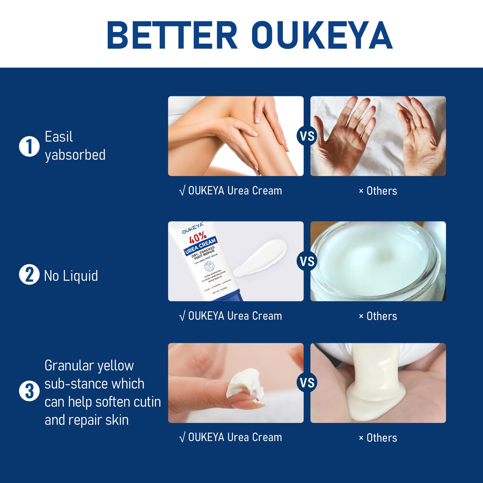 OUKEYA Urea Cream 40% for hands supports moisturization during daily routines.
