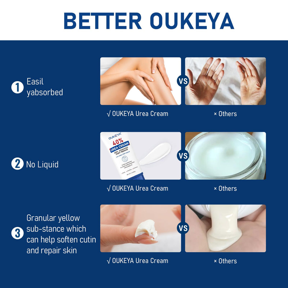 OUKEYA Urea Cream 40% for hands supports moisturization during daily routines.