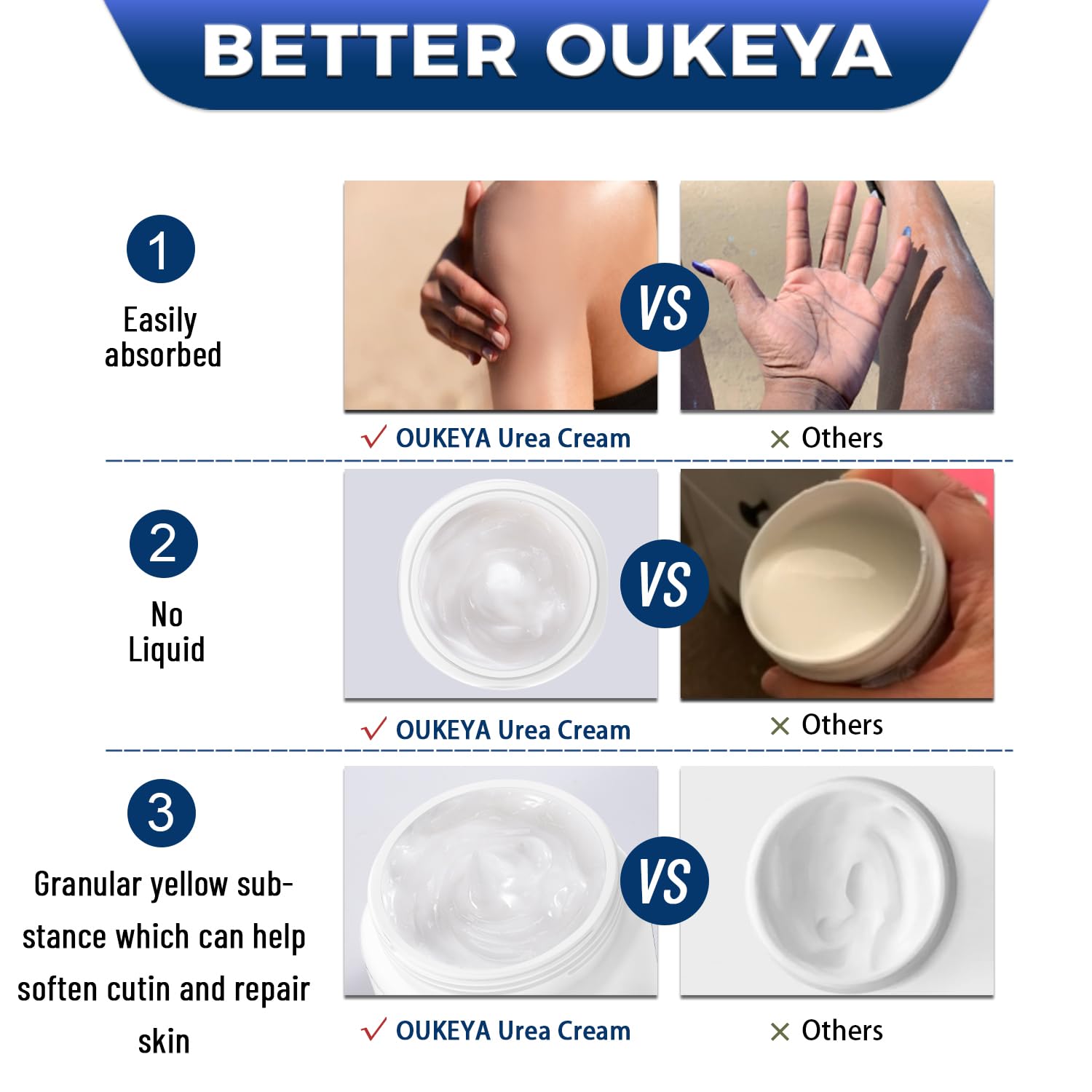 OUKEYA Urea Cream 42% hands image supports daily moisturization.