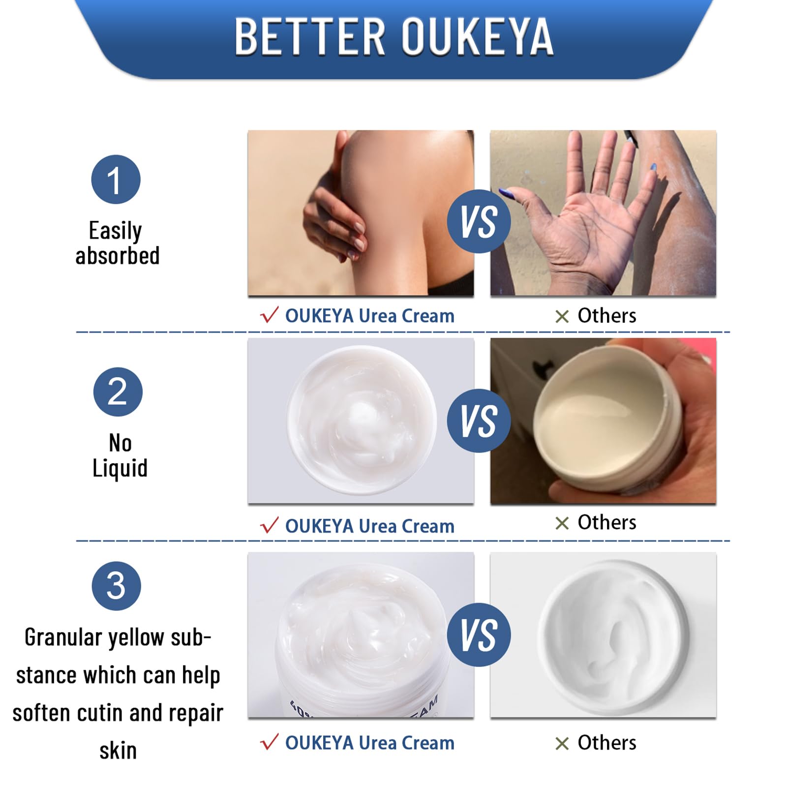 Uso diario con OUKEYA 40% urea para piel de manos y pies.