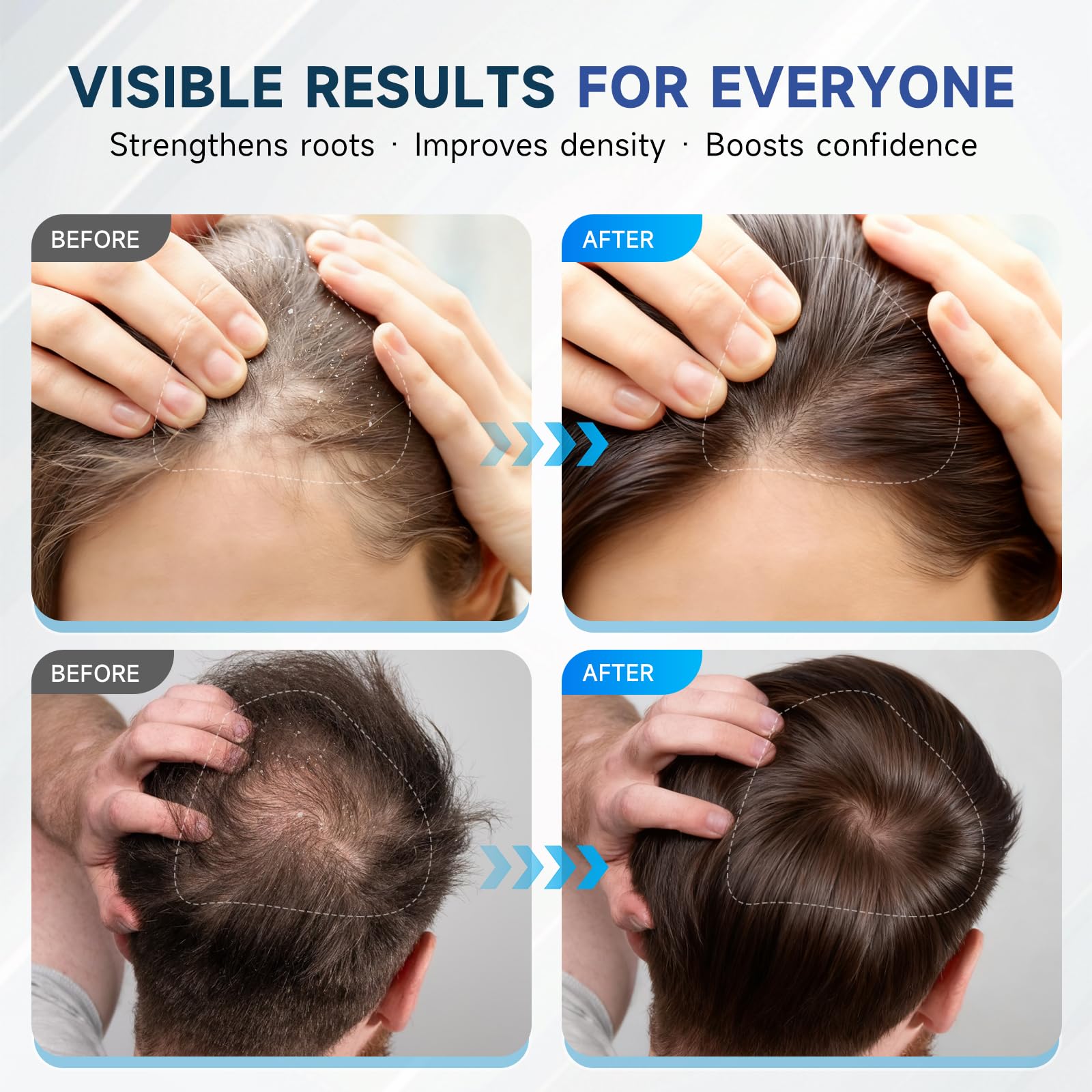 OVEXLIO rosemary leaves highlight the natural root-supporting formula for healthier-looking roots.