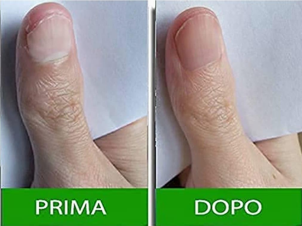 German formulation Pantogar shown for the Egyptian market.