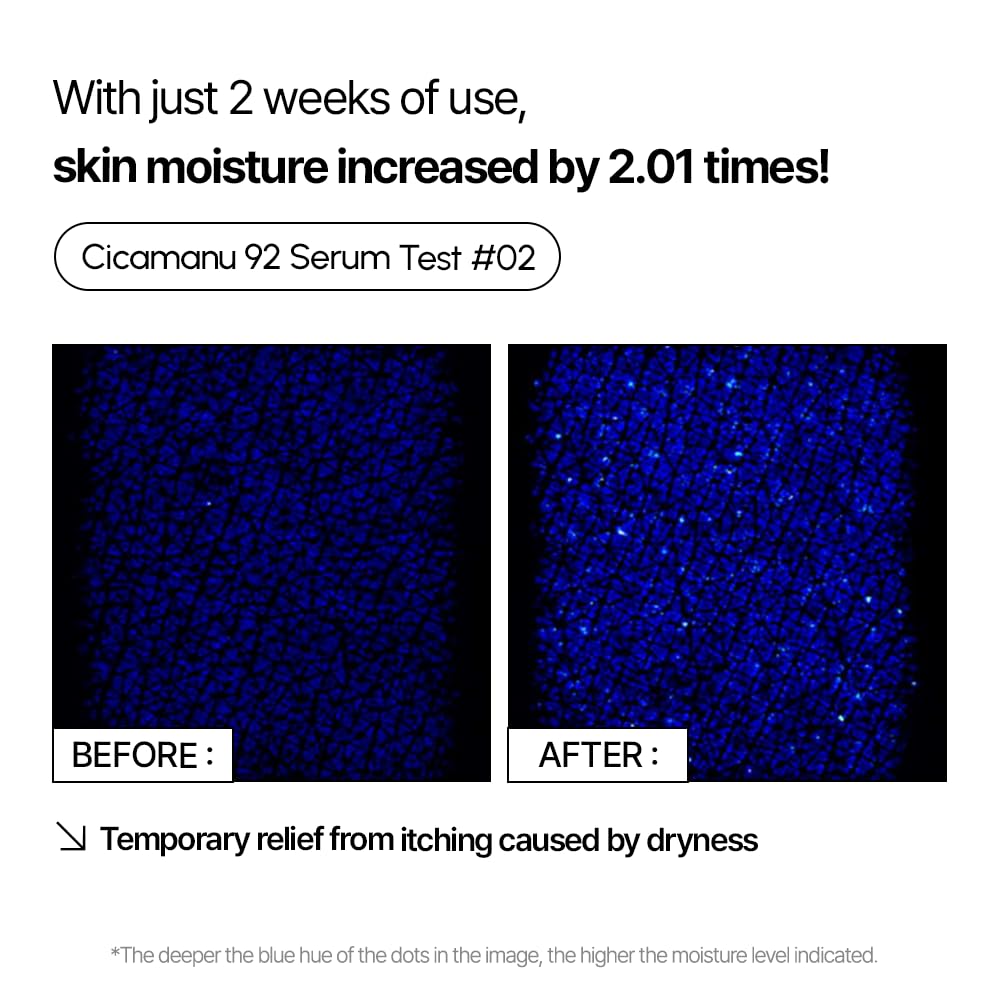Parnell Cicamanu 92 Serum Centella Asiática para calmar y reparar.