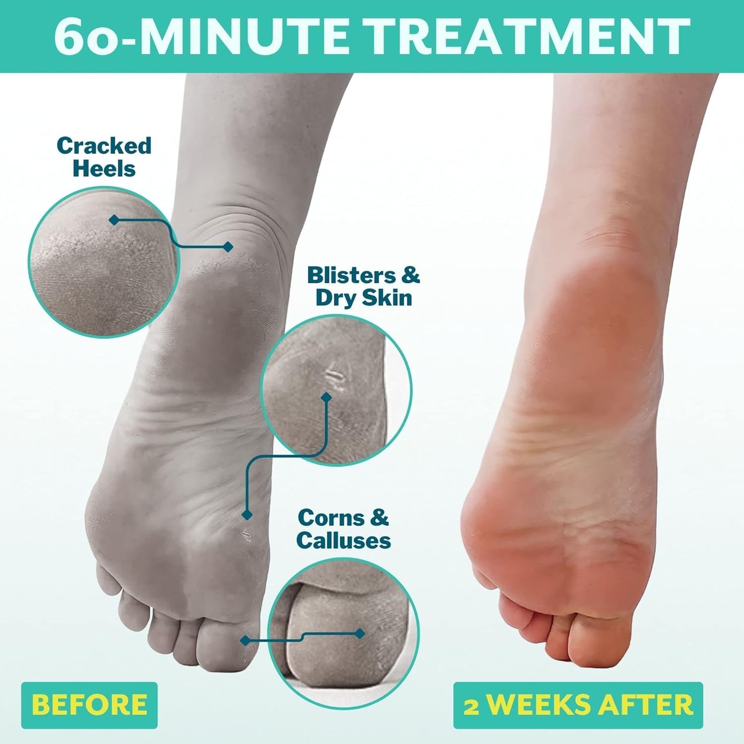 Patchology PoshPeel Pedi Cure: aplicación para pies, resultado suave tras la sesión