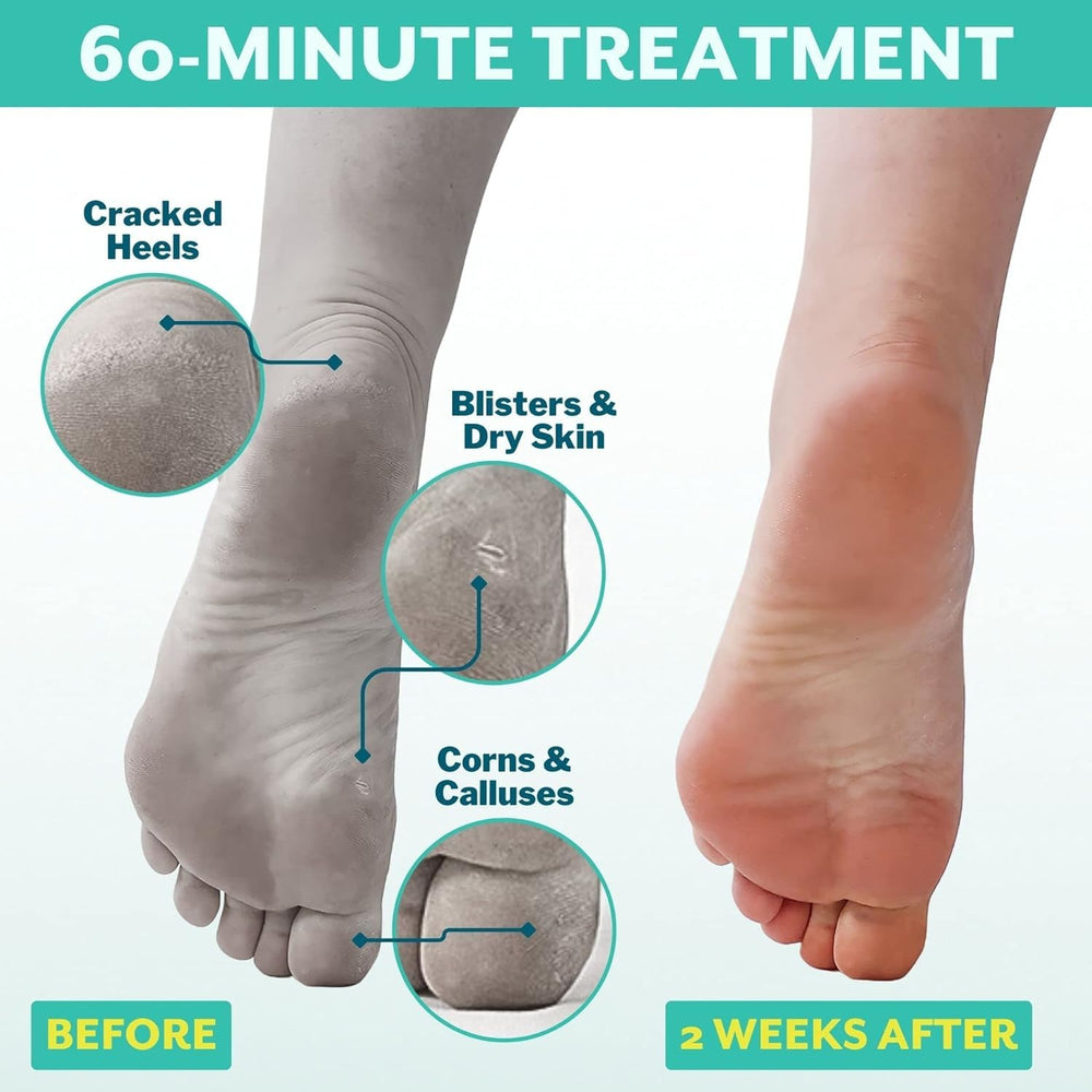 Patchology PoshPeel Pedi Cure: aplicación para pies, resultado suave tras la sesión