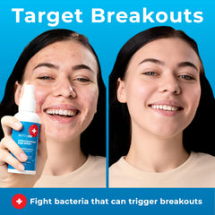 PatchRx Spray Reducción Enrojecimiento: calma la piel irritada con uso diario.