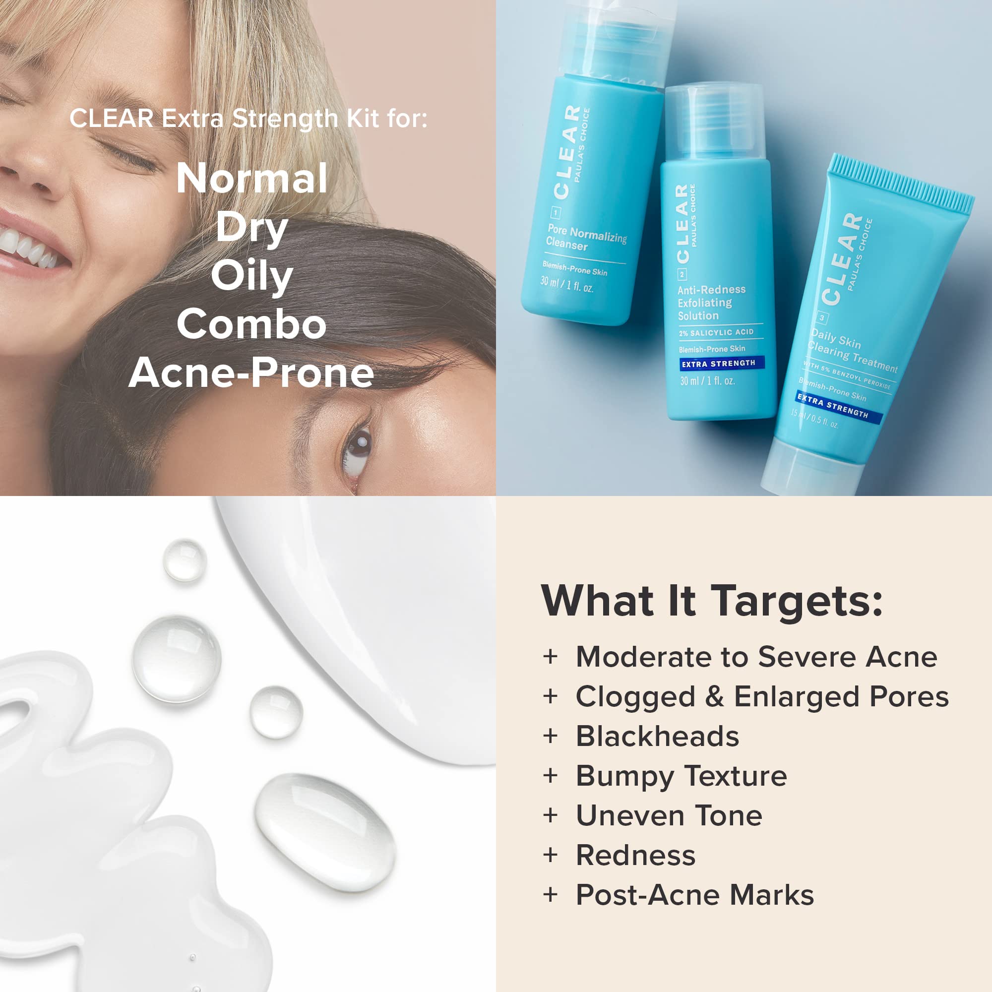 Paula's Choice acne treatment with benzoyl peroxide included in the kit for blemish care.
