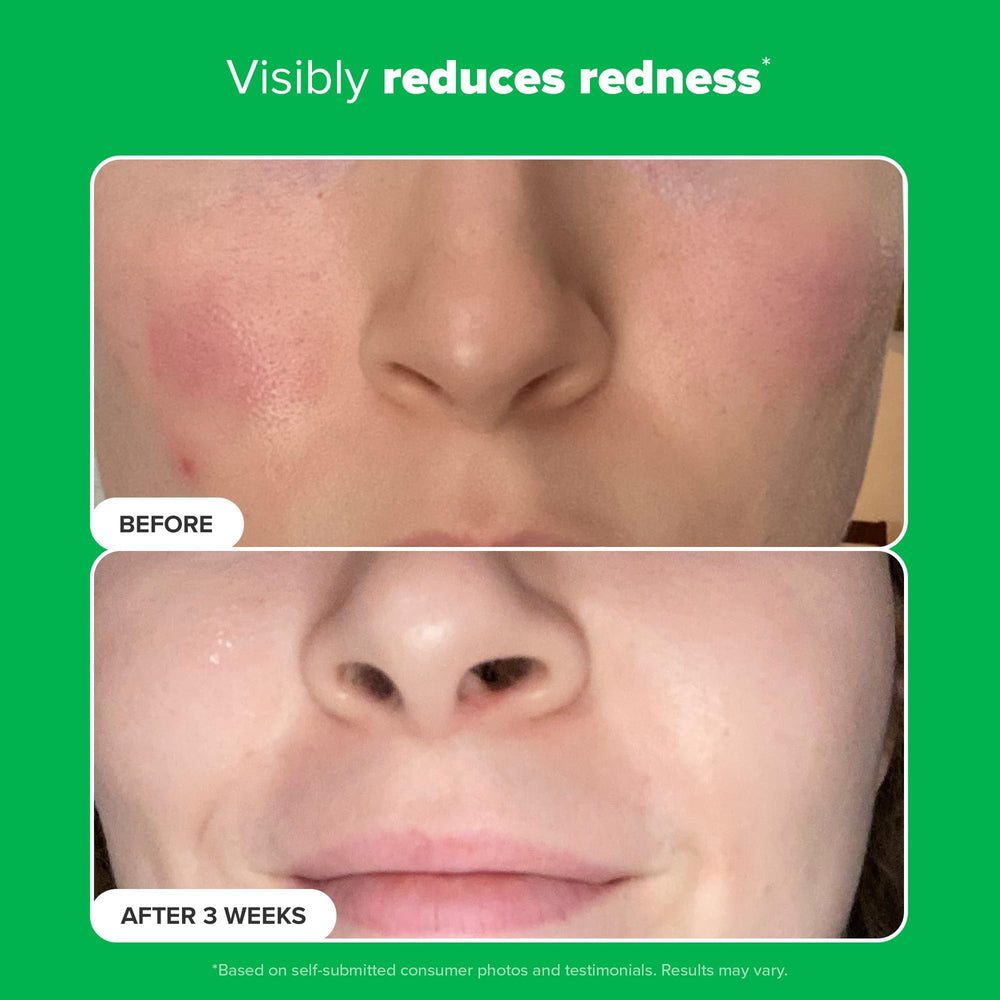 Paula's Choice Boost applied on skin demonstrates quick-absorbing, lightweight feel.
