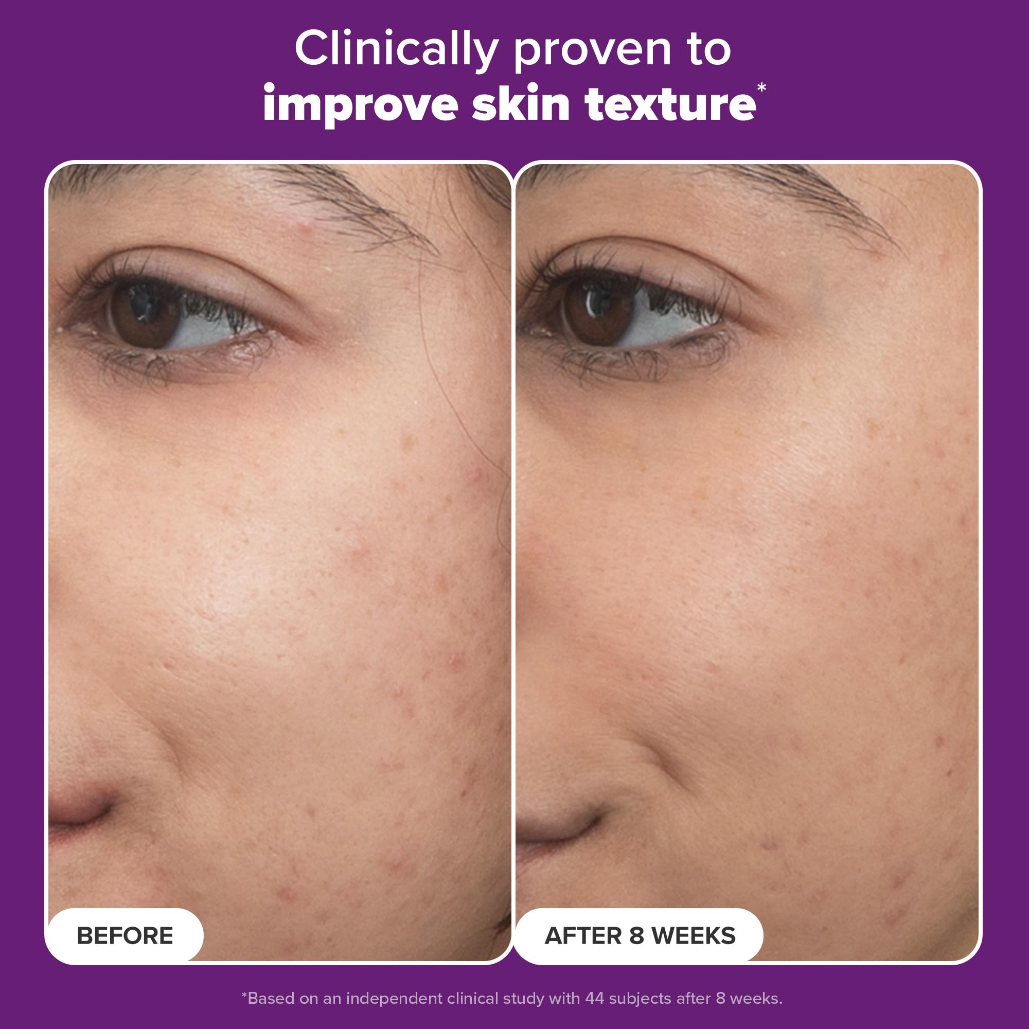 Paula's Choice Pro Retinaldehyde image suggests acne-prone skin benefits with clearer pores.