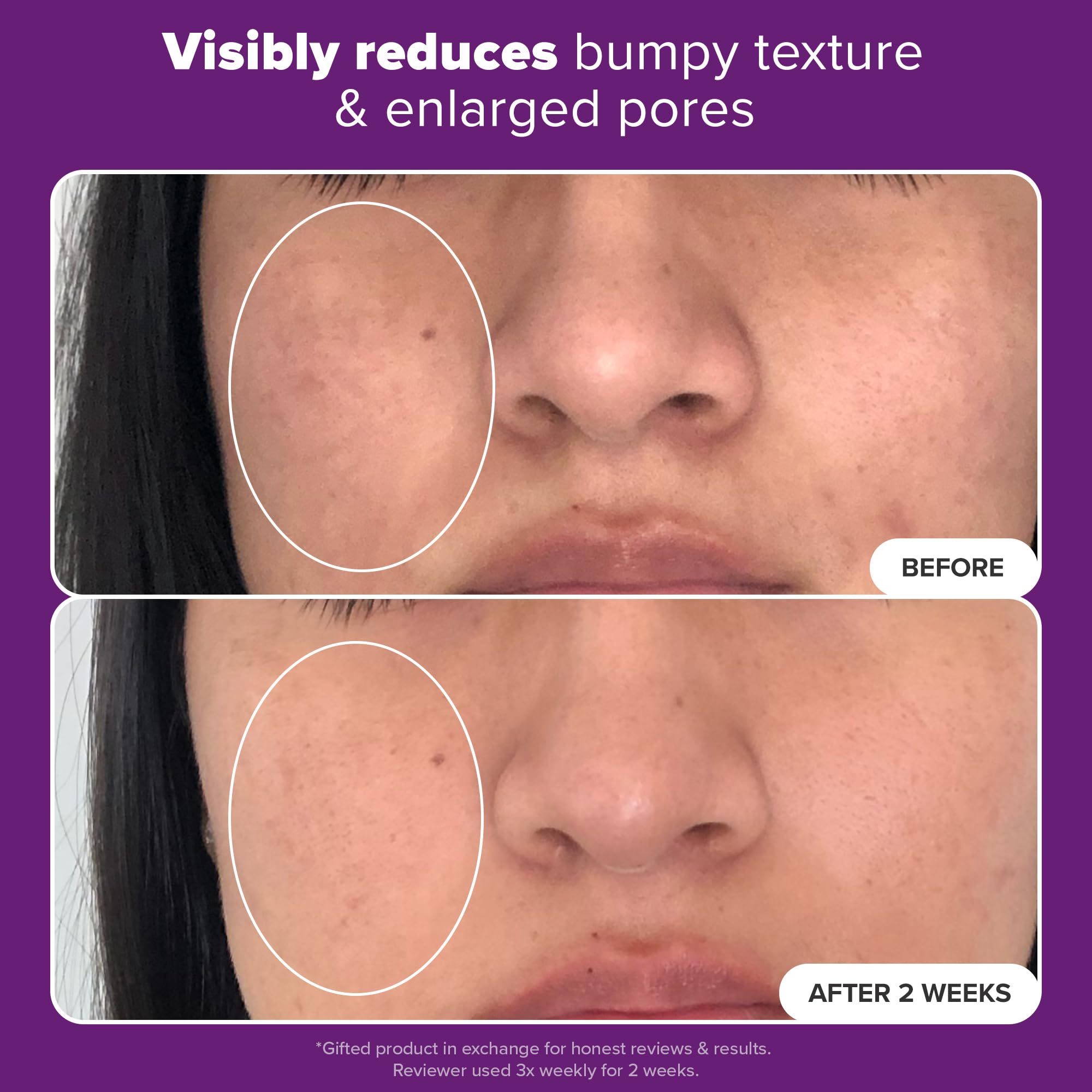 On-face application view showing a light, fast-absorbing serum layer.
