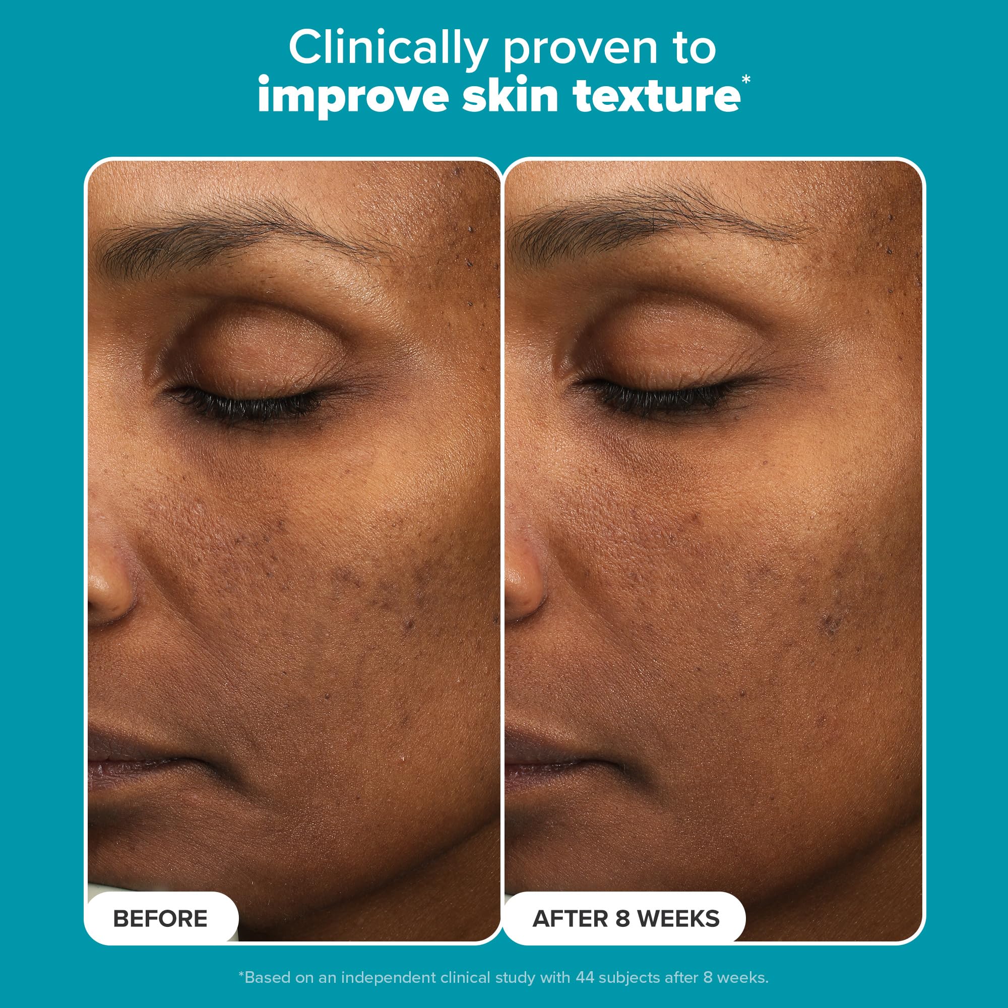 Envase de Paula's Choice exfoliante facial liquido muestra superficie suave para uso diario.