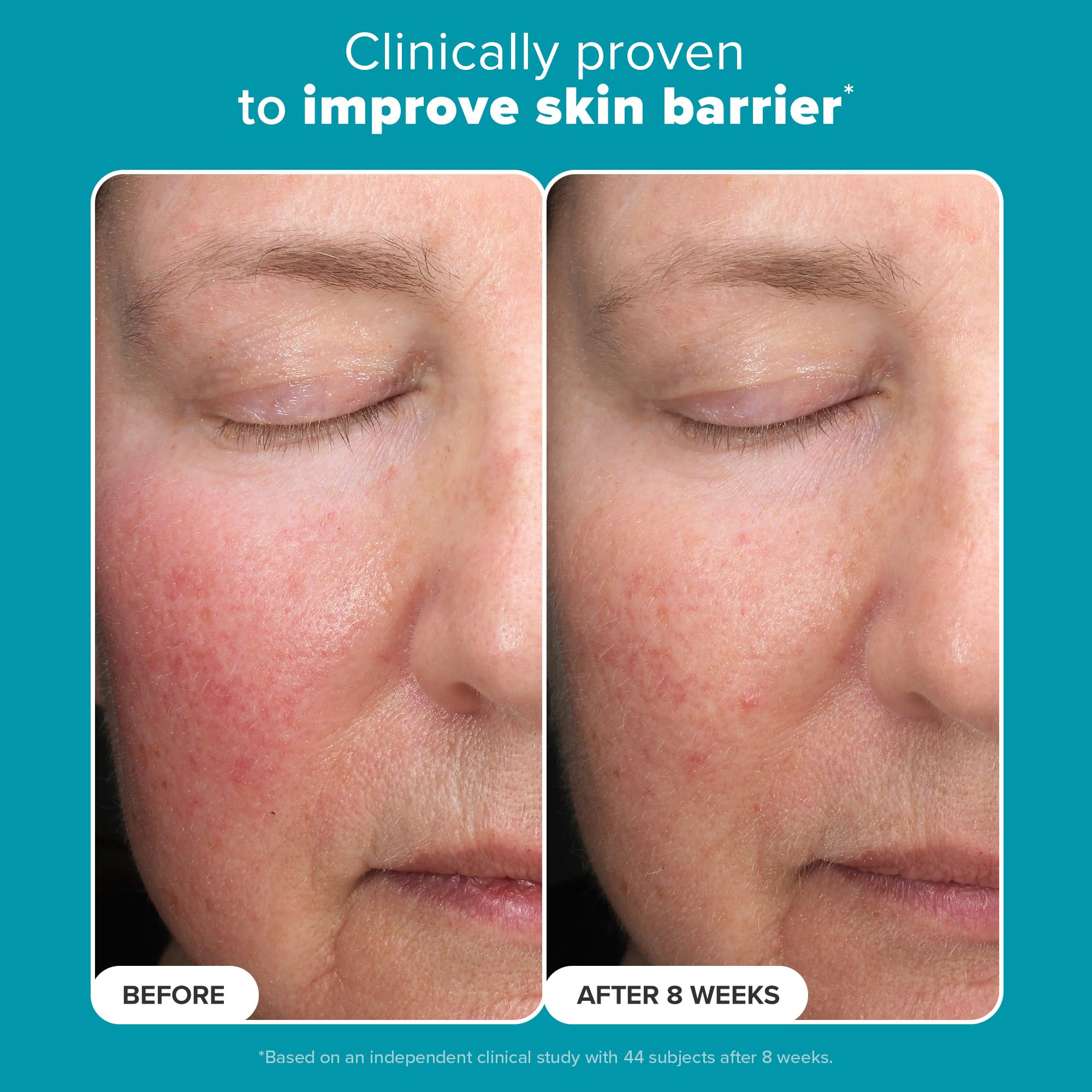 Fragrance-free label highlighted for sensitive skin on Paula's Choice exfoliant