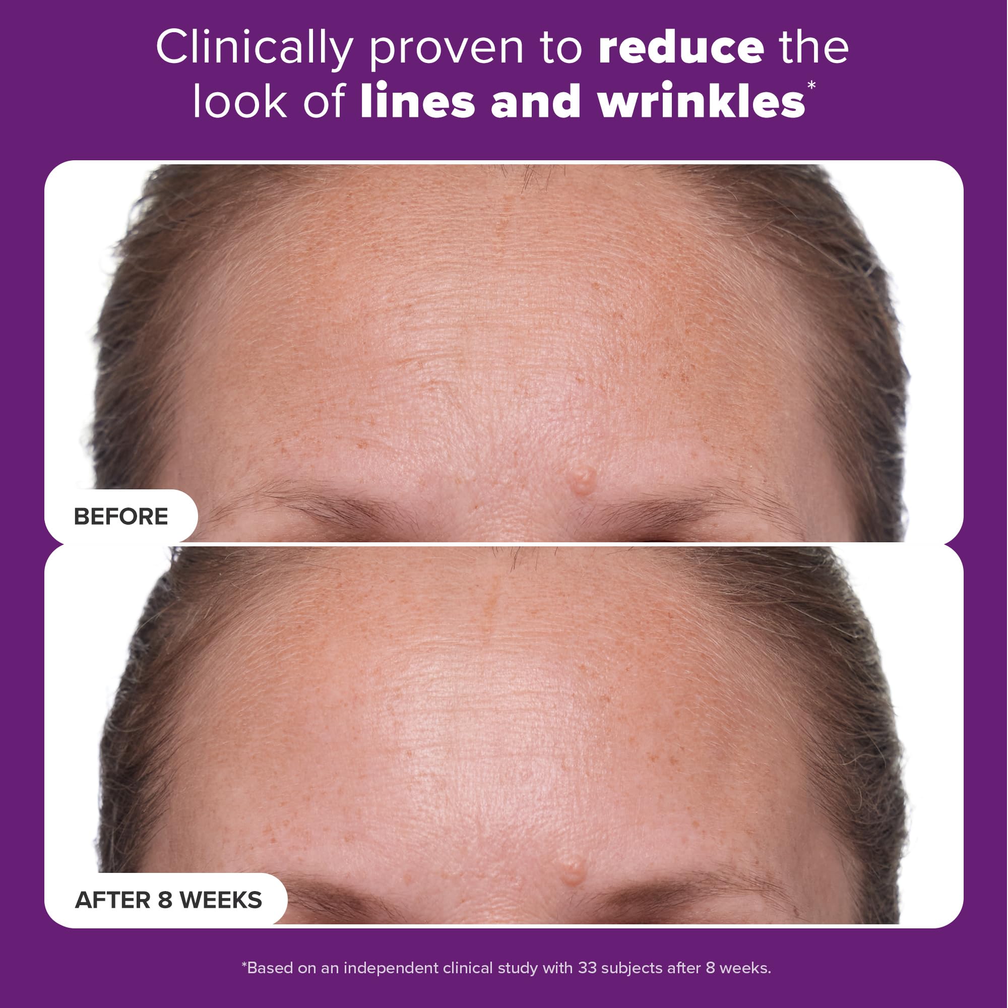 Retinol formula with hyaluronic acid for comfortable absorption