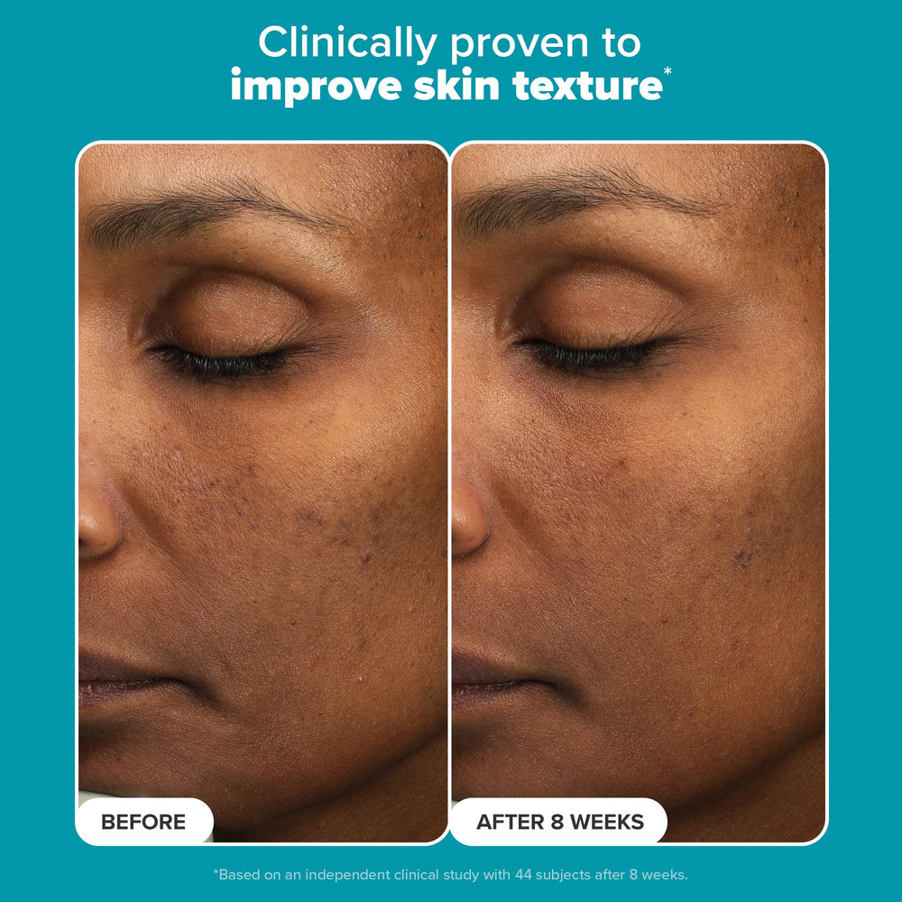 Illustration of even skin tone and subtle radiance after use