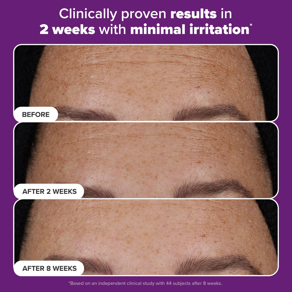 Paula's Choice Pro Retinaldehyde texture-smoothing application shot on skin.
