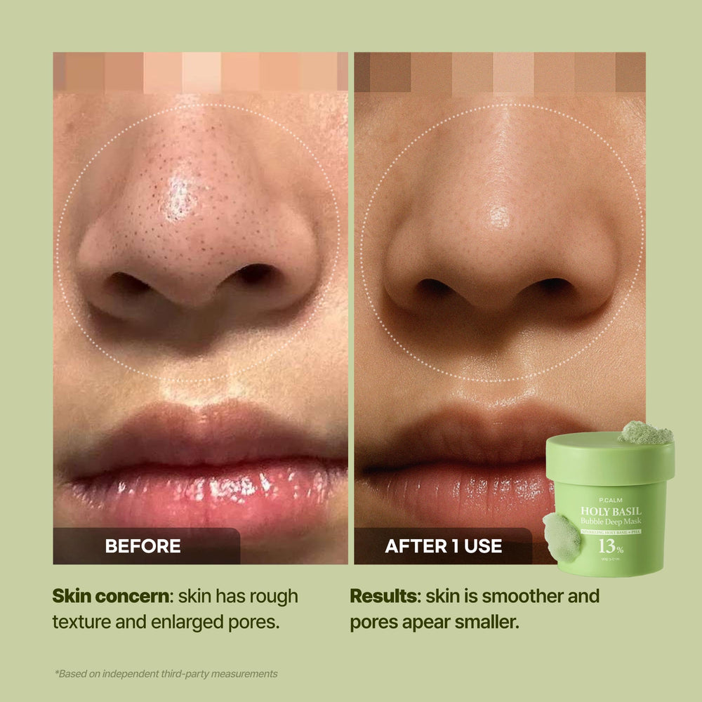 P.CALM All-skin-friendly formula packaging indicating gentle care.