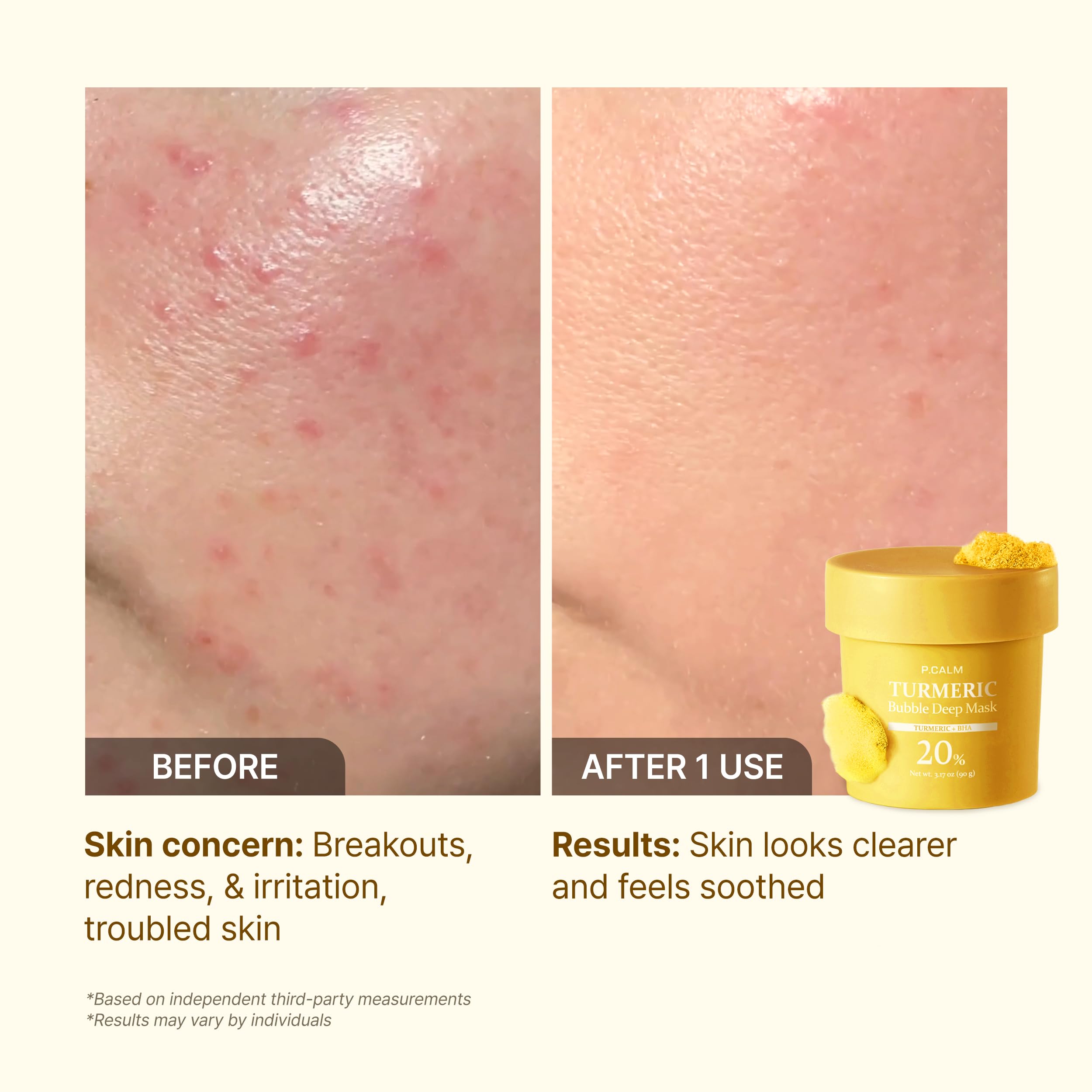 P.CALM Turmeric Bubble Deep Mask utiliza fórmula natural y suave para todo tipo de piel.