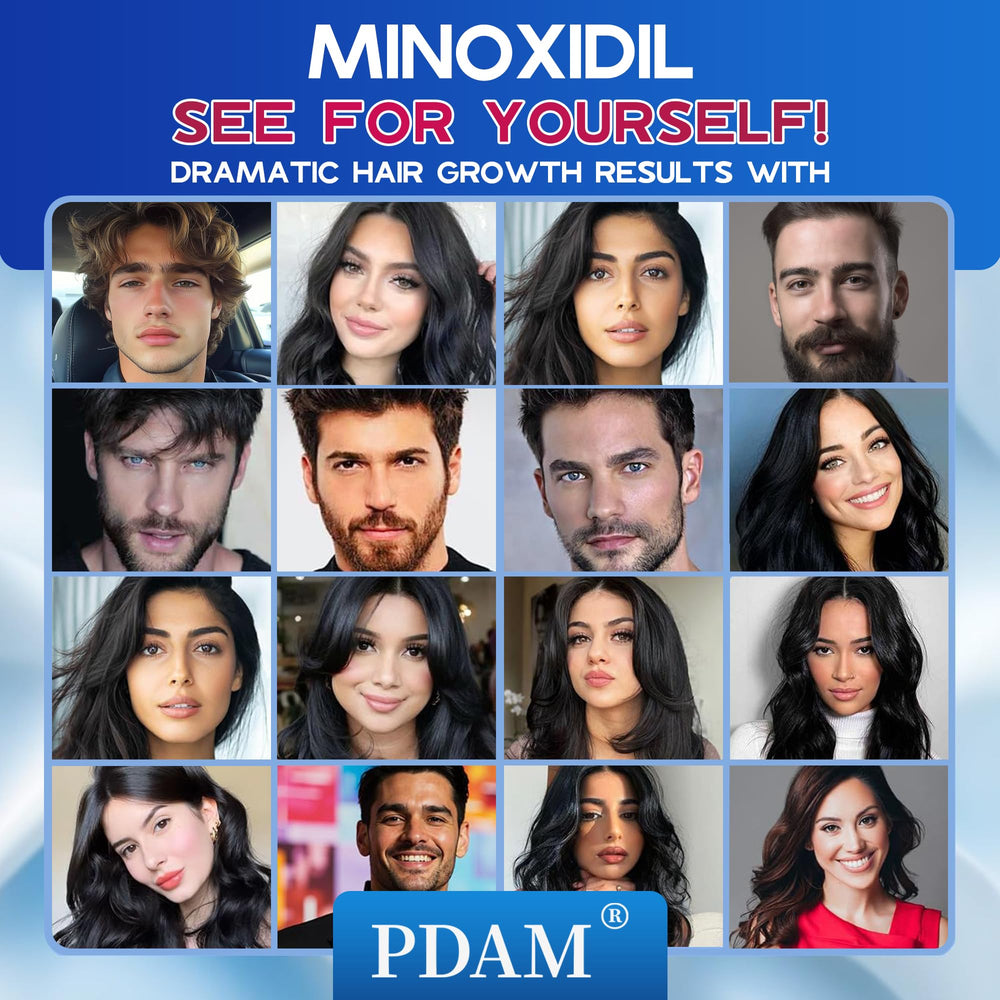 Pdam Minoxidil foam packaging indicates four-month supply