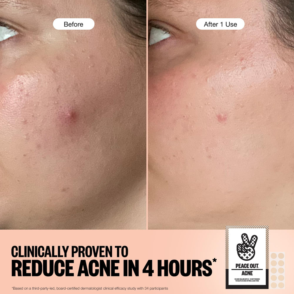 Peace Out 40-count pack for on-the-go skincare.