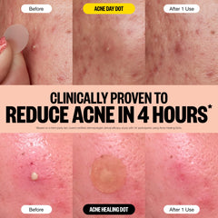 PEACE OUT Acne punto hidrocoloide impurezas: absorbe impurezas y protege la imperfección