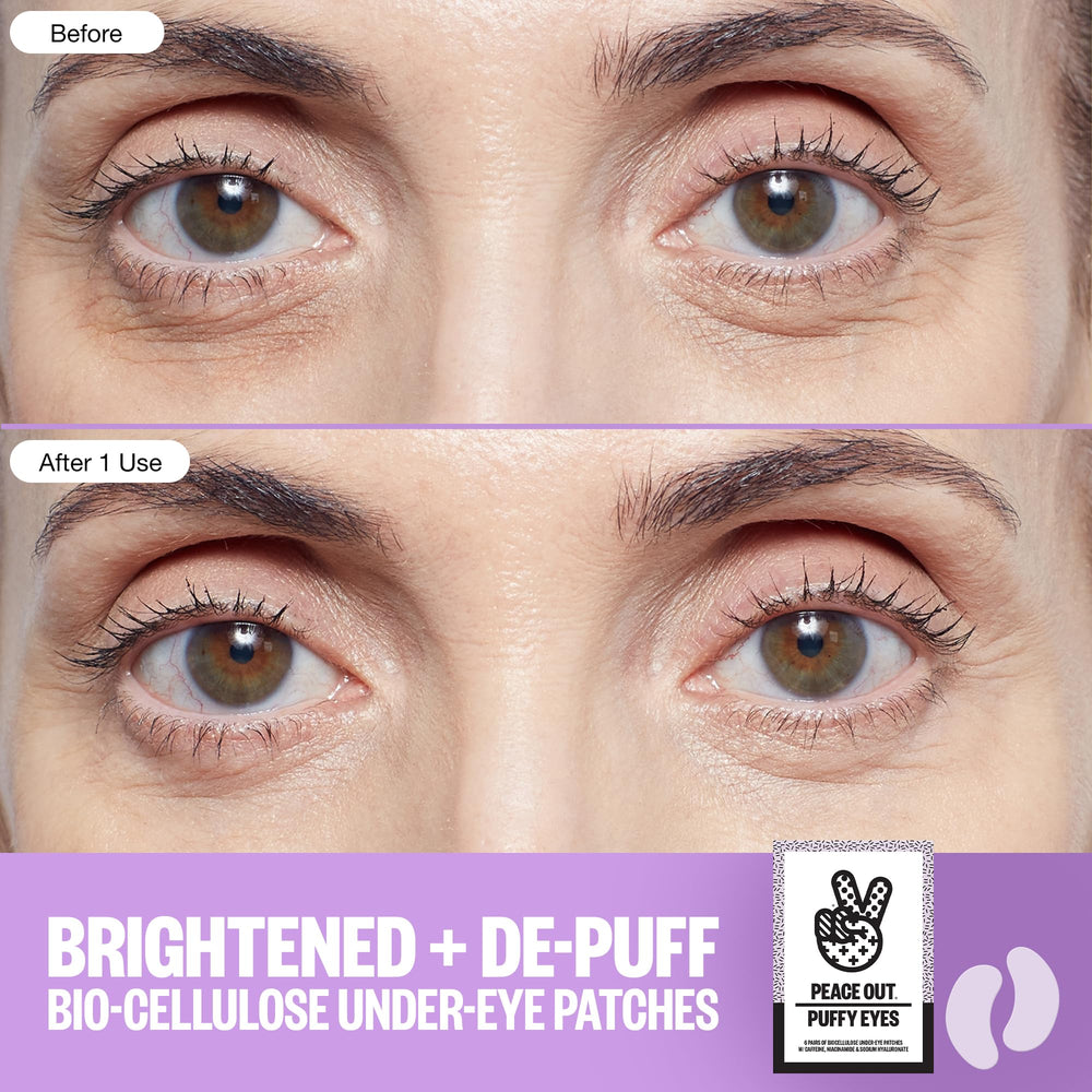 Peace Out eye patches cooling surface helps reduce puffiness and brighten appearance.