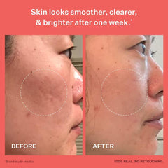Peach & Lily niacinamide and hyaluronic acid close-up for calm, brighten skin.