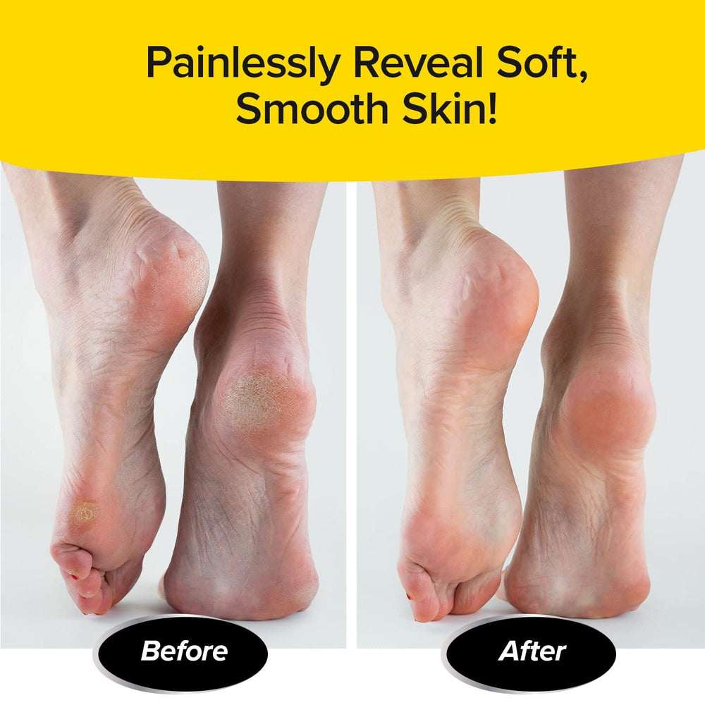Mess-free foot care with PedEgg keeps cleanup quick and simple.
