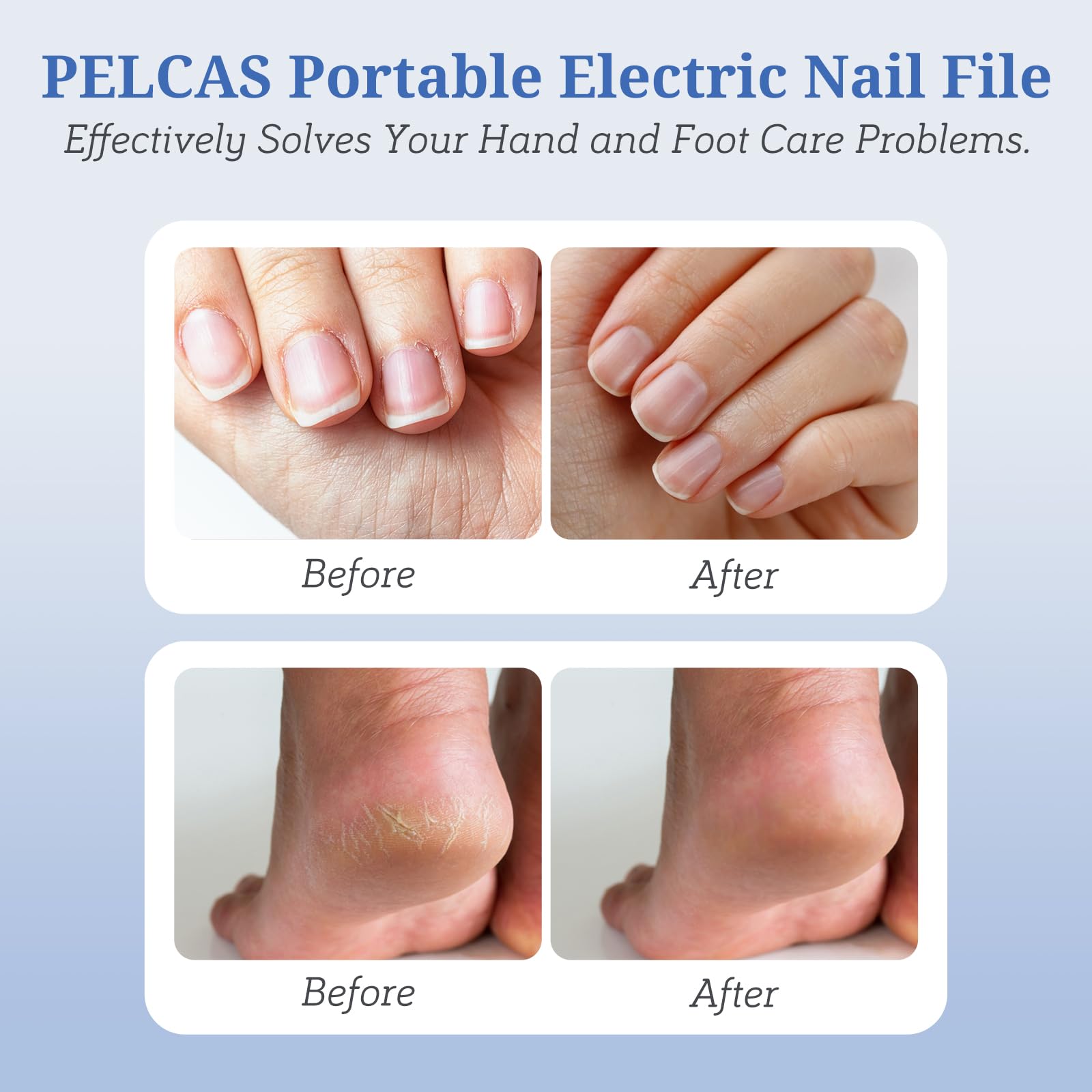 PELCA S 8-in-1 drill bits kit for versatile nail shaping and polishing.