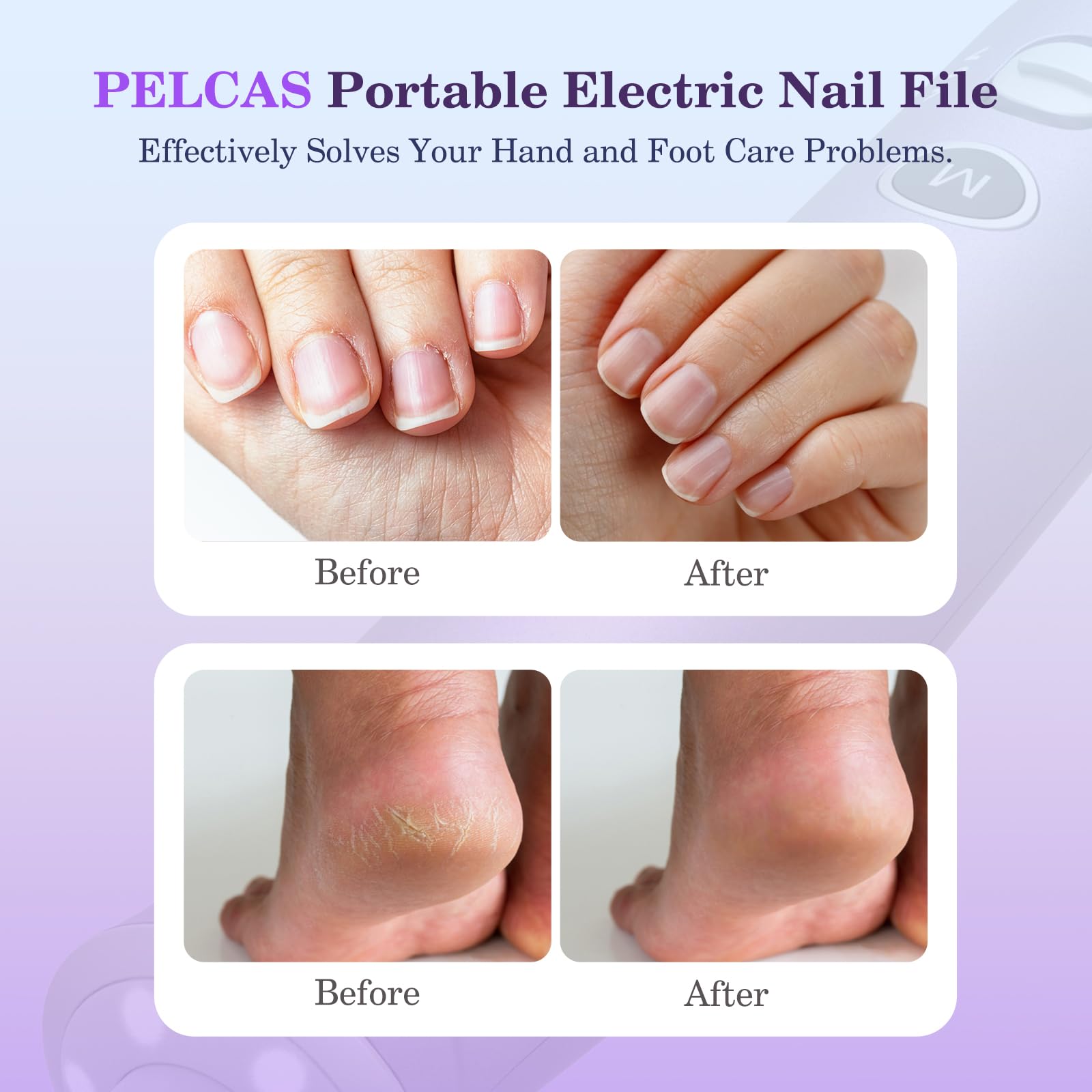 Pelcas cordless nail drill with 360° LED light for clear visibility.