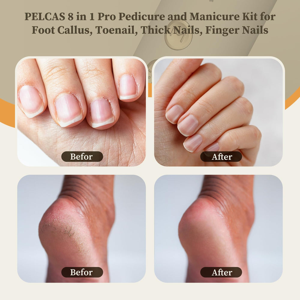 PELCA S LED light nail file for precise nail shaping