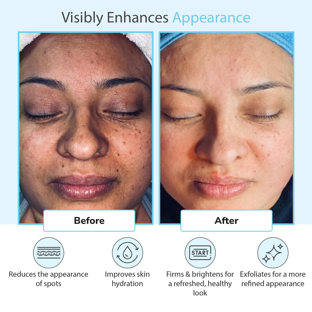 Perfect Image Glycolic Acid 50% gel peel closeup label design.