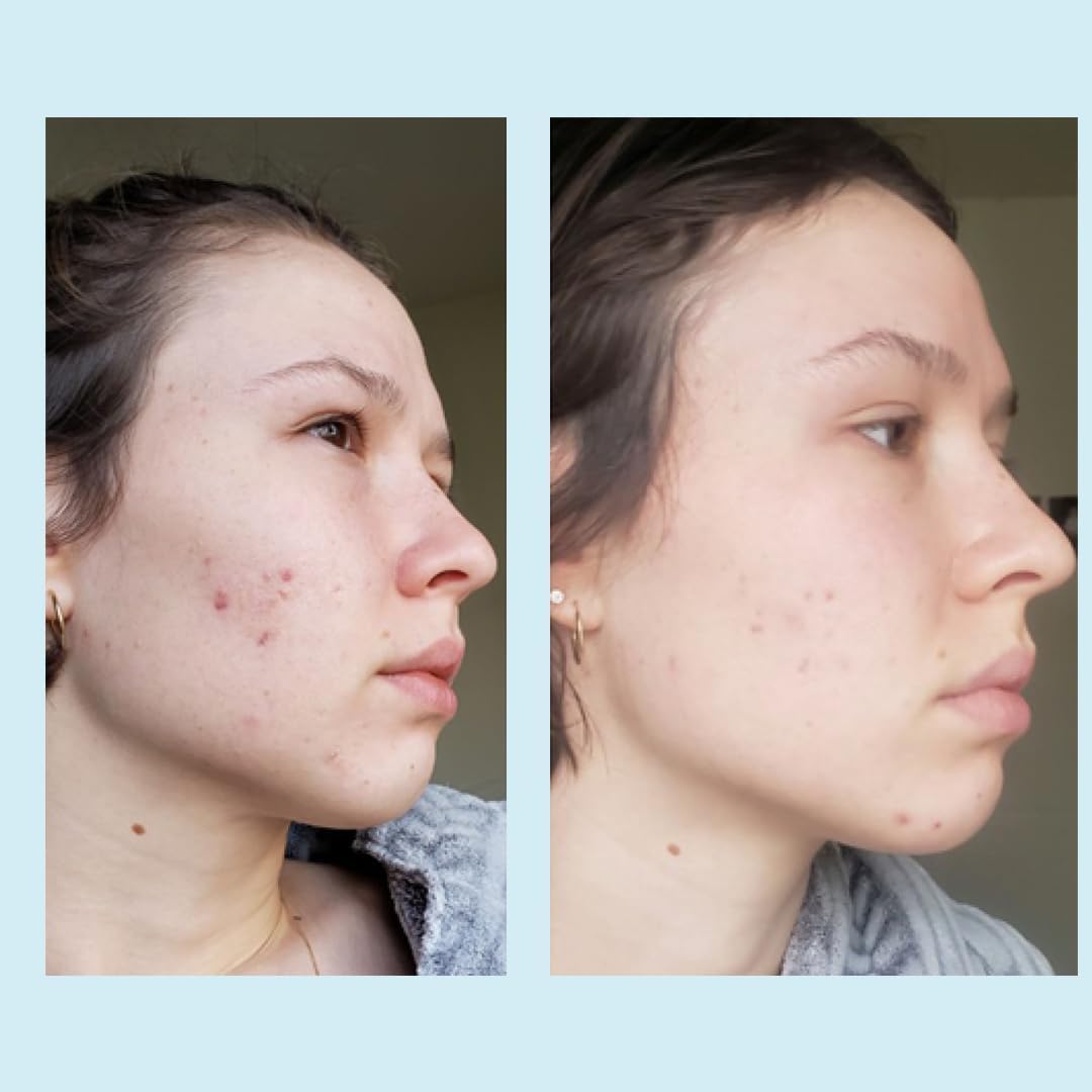 Perfect Image professional skin peel usage guide panel.