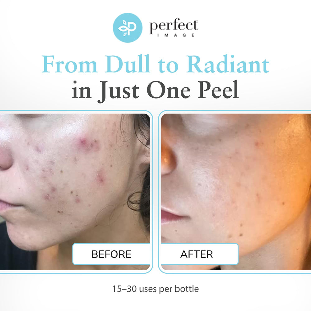 Perfect Image retinol green tea ingredients highlights smoothing and antioxidant benefits for skin.