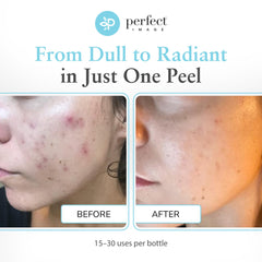 Perfect Image retinol green tea ingredients highlights smoothing and antioxidant benefits for skin.